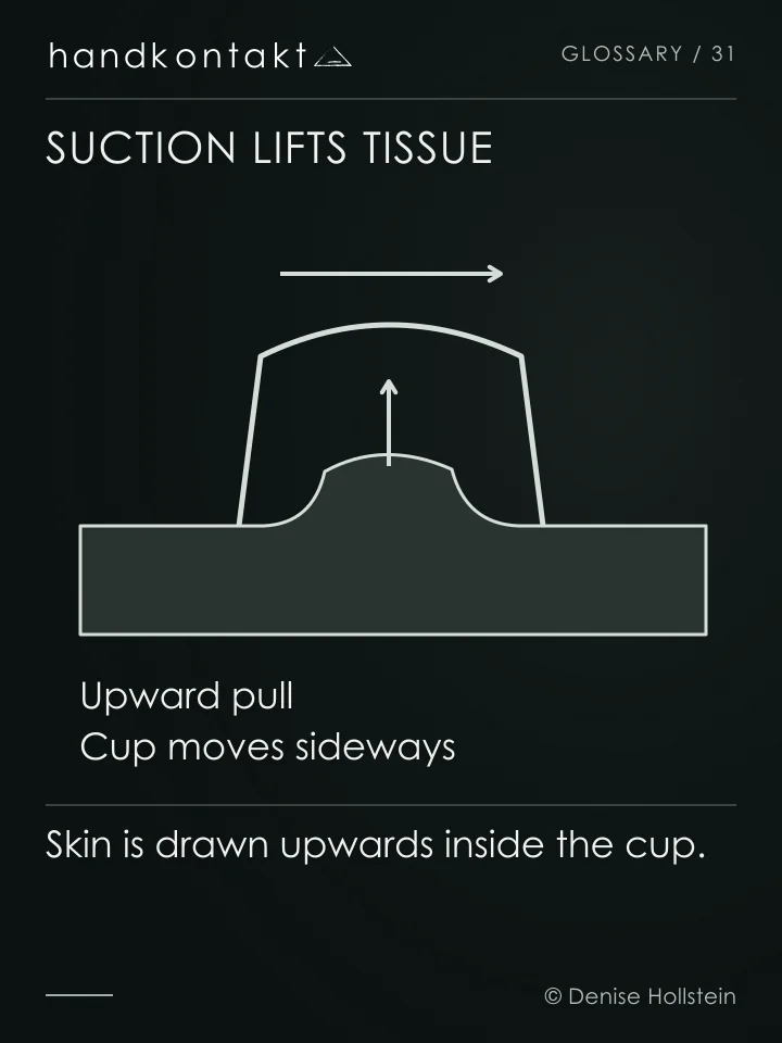 A cup lifts skin by suction. The vertical arrow shows the lift; the horizontal arrow shows the cup moving across the skin.